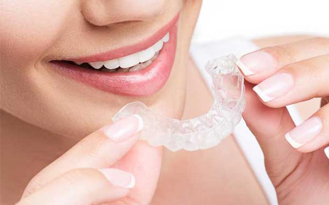 ホームホワイトニング