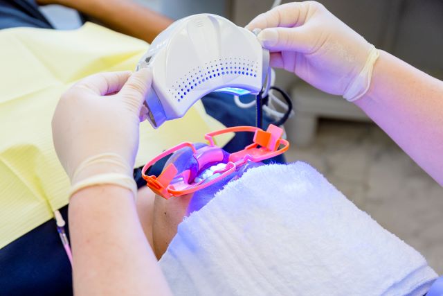 オフィスホワイトニング